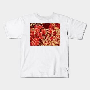 Blood clot, SEM (P260/0107) Kids T-Shirt